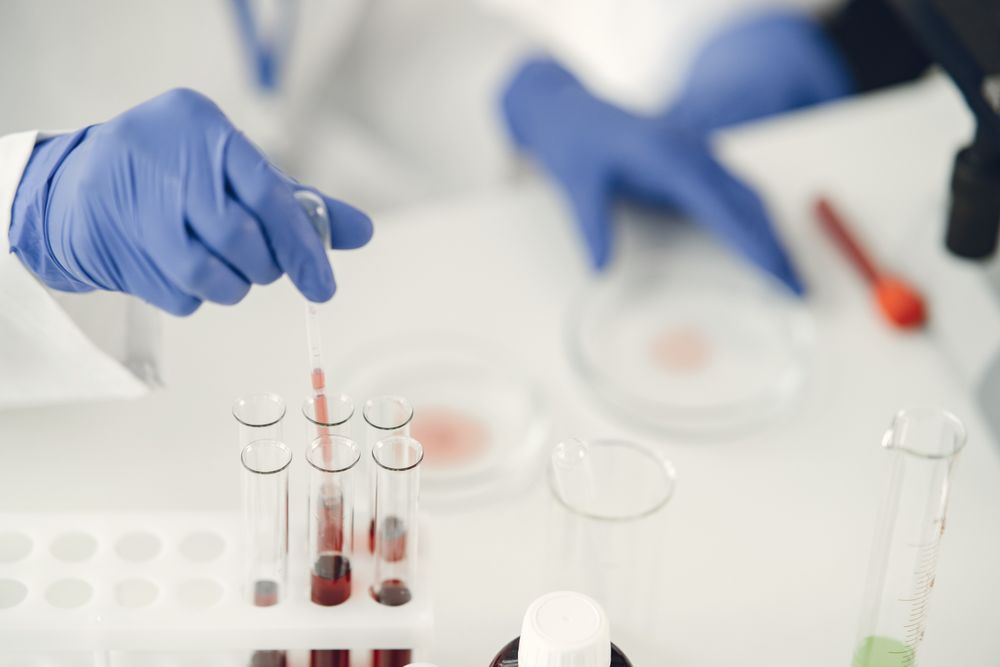 Person mit Schutzhandschuhen entnimmt mit einer Pipette eine Probe im Labor